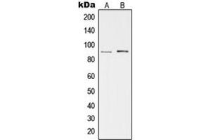 Western blot analysis of cGK 2 expression in HeLa (A), Hs67 (B) whole cell lysates. (PRKG2 antibody  (Center))