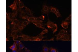 Immunofluorescence analysis of C6 cells using NRP1 Polyclonal Antibody at dilution of 1:100. (Neuropilin 1 antibody)