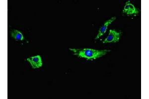 Immunofluorescent analysis of Hela cells using ABIN7168509 at dilution of 1:100 and Alexa Fluor 488-congugated AffiniPure Goat Anti-Rabbit IgG(H+L) (RYR2 antibody  (AA 901-1192))