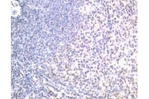 Immunohistochemistry (IHC) image for anti-Tumor Necrosis Factor Receptor Superfamily, Member 10b (TNFRSF10B) (Extracellular Domain) antibody (ABIN342736) (TNFRSF10B antibody  (Extracellular Domain))