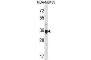 Western Blotting (WB) image for anti-Fibrinogen-Like 1 (FGL1) antibody (ABIN2996869) (FGL1 antibody)