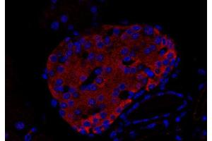 Immunohistochemistry (IHC) image for anti-Uncoating ATPase (AA 1-650) antibody (ABIN1742323) (Uncoating ATPase (AA 1-650) antibody)