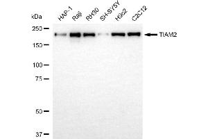 Western blotting analysis using TIAM2 antibody (ABIN7800500).