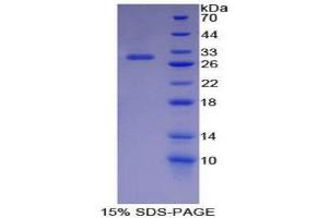 SDS-PAGE (SDS) image for Inhibitor of KB Kinase beta Interacting Protein (IKbIP) (AA 78-301) protein (His tag) (ABIN2125257)