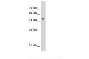 Image no. 1 for anti-SERPINE1 mRNA Binding Protein 1 (SERBP1) (AA 243-292) antibody (ABIN6736304) (SERBP1 antibody  (AA 243-292))