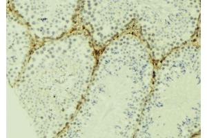 ABIN6277135 at 1/100 staining Mouse testis tissue by IHC-P. (SPDYA antibody  (Internal Region))