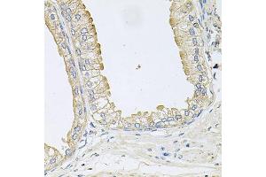 Immunohistochemistry of paraffin-embedded human prostate using ANKH antibody. (ANKH antibody)