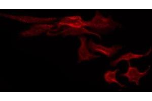 ABIN6274945 staining HeLa by IF/ICC. (ABCC3 antibody  (Internal Region))