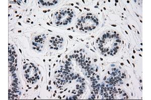 Immunohistochemical staining of paraffin-embedded breast tissue using anti-TYRO3 mouse monoclonal antibody. (TYRO3 antibody)