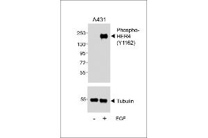 Western blot analysis of lysates from A431 cell line, untreated or treated with EGF, 100 ng/mL, using (ABIN389572 and ABIN2839598) (upper) or Tubulin (lower). (ERBB4 antibody  (pTyr1162))