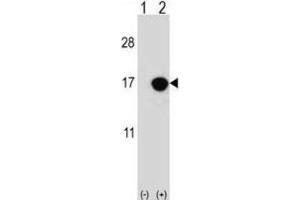 Western Blotting (WB) image for anti-Cyclin-Dependent Kinase Inhibitor 2B (p15, Inhibits CDK4) (CDKN2B) antibody (ABIN2996859)