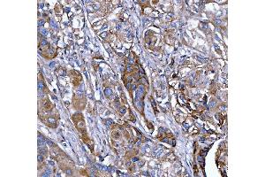 IHC analysis of Kindlin 2/FERMT2 using anti-Kindlin 2/FERMT2 antibody (ABIN7599515). (FERMT2 antibody  (AA 1-650))