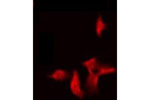 ABIN6275300 staining Hela by IF/ICC. (NBPF5 antibody)