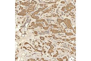 IHC analysis of Citrin/SLC25A13 using anti-Citrin/SLC25A13 antibody (ABIN7599512). (slc25a13 antibody  (AA 1-643))