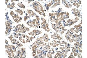 GTPBP9 antibody was used for immunohistochemistry at a concentration of 4-8 ug/ml to stain Skeletal muscle cells (arrows) in Human Muscle. (OLA1 antibody)