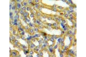 Used in DAB staining on fromalin fixed paraffin-embedded Kidney tissue (PAFAH1B3 antibody  (AA 28-231))