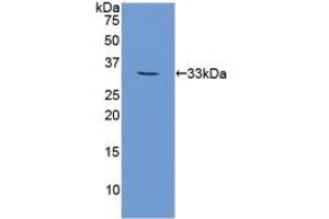 Western blot analysis of recombinant Human CAPN1. (CAPNL1 antibody  (AA 75-343))