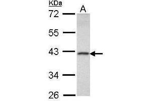 WB Image Sample (30 ug of whole cell lysate) A: Raji 10% SDS PAGE antibody diluted at 1:1000 (DEDD antibody)