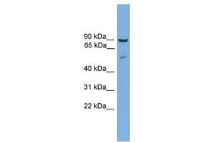 Cornulin antibody used at 1 ug/ml to detect target protein. (CRNN antibody  (Middle Region))