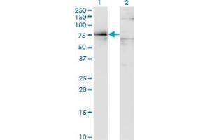 Western Blot analysis of DMD expression in transfected 293T cell line by DMD monoclonal antibody (M07), clone 3A11.