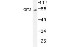 Image no. 1 for anti-G Protein-Coupled Receptor Kinase Interactor 2 (GIT2) antibody (ABIN272229)