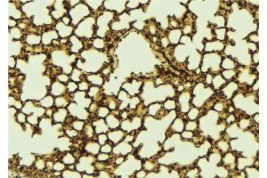 ABIN6267187 at 1/100 staining Mouse lung tissue by IHC-P.