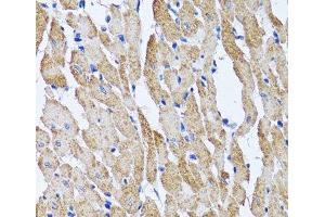 Immunohistochemistry of paraffin-embedded Mouse heart using ATP5B Polyclonal Antibody at dilution of 1:100 (40x lens). (ATP5B antibody)