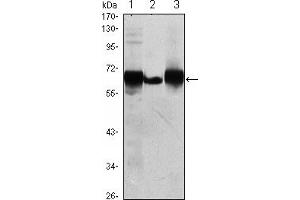 Western blot analysis using ALPP mouse mAb against HepG2 (1), A431 (2) and MCF-7 (3) cell lysate. (PLAP antibody)