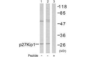 Image no. 2 for anti-Cyclin-Dependent Kinase Inhibitor 1B (p27, Kip1) (CDKN1B) (Ser10) antibody (ABIN197350) (CDKN1B antibody  (Ser10))