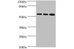 Western blot All lanes: Acyl-coenzyme A synthetase ACSM3, mitochondrial antibody at 10 μg/mL Lane 1: 293T whole cell lysate Lane 2: Mouse kidney tissue Lane 3: A431 whole cell lysate Secondary Goat polyclonal to rabbit IgG at 1/10000 dilution Predicted band size: 67, 50 kDa Observed band size: 67 kDa (ACSM3 antibody  (AA 387-586))
