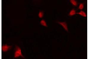 ABIN6267600 staining HeLa by IF/ICC. (NF-kB p65 antibody  (pThr254))