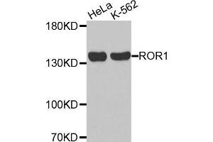 Western blot analysis of extracts of various cell lines, using ROR1 antibody. (ROR1 antibody  (AA 30-200))