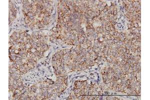 Image no. 1 for anti-Protoporphyrinogen Oxidase (PPOX) (AA 378-478) antibody (ABIN598883) (PPOX antibody  (AA 378-478))