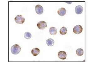 Image no. 3 for anti-Nucleotide-Binding Oligomerization Domain Containing 2 (NOD2) (C-Term) antibody (ABIN372922) (NOD2 antibody  (C-Term))
