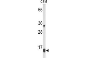 Western Blotting (WB) image for anti-DIRAS Family, GTP-Binding RAS-Like 1 (DIRAS1) antibody (ABIN5024693) (DIRAS1 antibody)