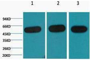 Western Blotting (WB) image for anti-Tubulin, beta (TUBB) antibody (ABIN3181209) (TUBB antibody)