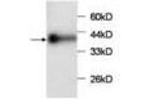 Image no. 1 for anti-Chemokine (C-C Motif) Ligand 2 (CCL2) antibody (ABIN791500) (CCL2 antibody)