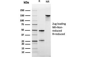 SDS-PAGE Analysis Purified CD47 Mouse Monoclonal Antibody (IAP/964). (CD47 antibody)