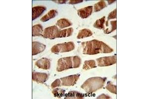 Formalin-fixed and paraffin-embedded human skeletal muscle reacted with CSRP2BP Antibody (Center), which was peroxidase-conjugated to the secondary antibody, followed by DAB staining. (CSRP2BP antibody  (AA 246-275))