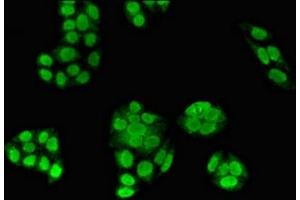 Immunofluorescent analysis of PC-3 cells using ABIN7176539 at dilution of 1:100 and Alexa Fluor 488-congugated AffiniPure Goat Anti-Rabbit IgG(H+L) (Zinc Finger Protein 816A (ZNF816A) (AA 1-200) antibody)
