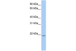 WB Suggested Anti-RNF5 Antibody Titration: 0. (RNF5 antibody  (N-Term))
