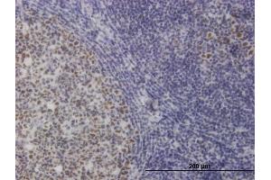 Immunoperoxidase of monoclonal antibody to TOE1 on formalin-fixed paraffin-embedded human tonsil.