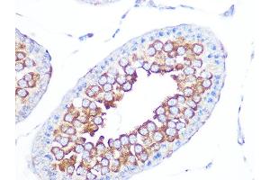 Immunohistochemistry (IHC) image for anti-Proliferation-Associated 2G4, 38kDa (PA2G4) antibody (ABIN7269550)