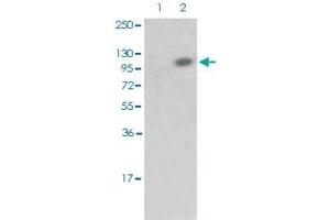 Western blot analysis of Lane 1: antigen-specific peptide treated JK cells, Lane 2: JK cells with RB1 (phospho S608) polyclonal antibody  at 1:500-1:1000 dilution. (Retinoblastoma 1 antibody  (pSer608))