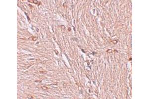 Immunohistochemistry (IHC) image for anti-Zinc Finger and BTB Domain Containing 4 (ZBTB4) (C-Term) antibody (ABIN1030812) (ZBTB4 antibody  (C-Term))