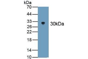 Detection of Recombinant APOB100, Cattle using Polyclonal Antibody to Apolipoprotein B100 (APOB100) (Apo-B100 antibody  (AA 4331-4567))