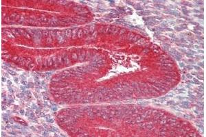 Human Uterus: Formalin-Fixed, Paraffin-Embedded (FFPE) (ZFP36L1 antibody  (AA 46-95))