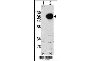 Western blot analysis of PYGM using rabbit polyclonal PYGM Antibody using 293 cell lysates (2 ug/lane) either nontransfected (Lane 1) or transiently transfected with the PYGM gene (Lane 2).
