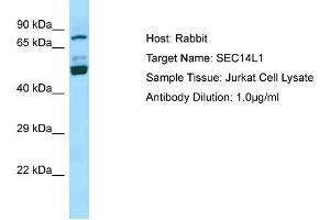 Western Blotting (WB) image for anti-SEC14-Like 1 (SEC14L1) (N-Term) antibody (ABIN2790166) (SEC14L1 antibody  (N-Term))