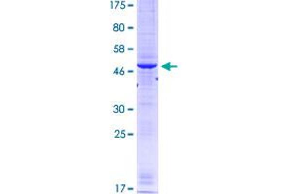 RRM1 Protein (AA 593-792) (GST tag)